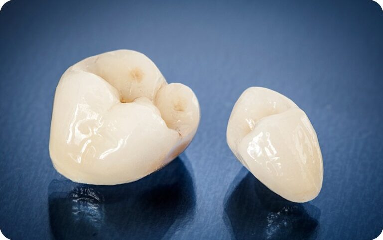 demo of teeth crowns