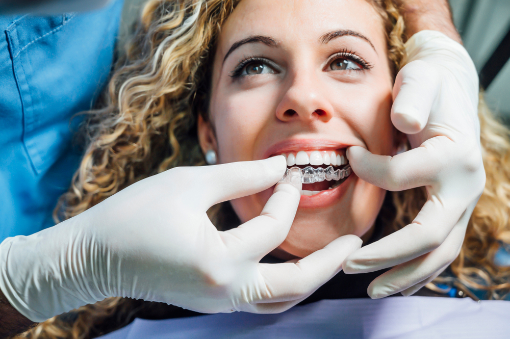 Invisalign in NE Calgary