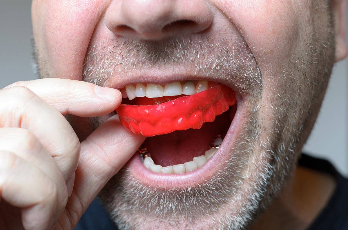 a man is putting mouthguards on his teeth