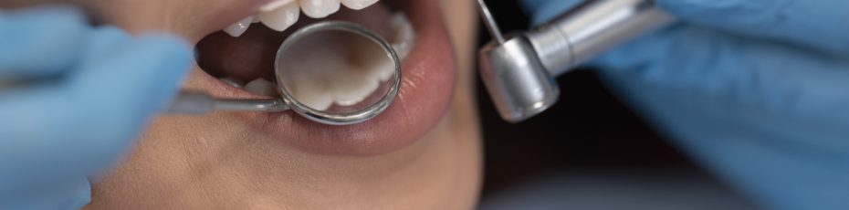 a female is getting dental crown treatment